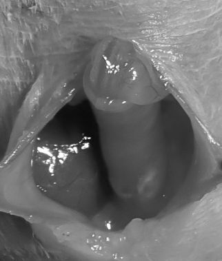 P40600781